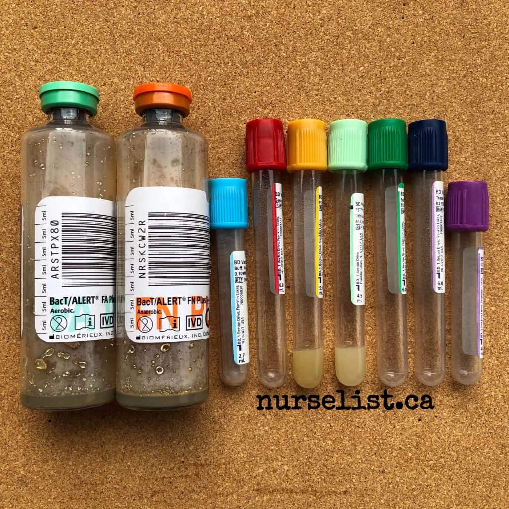 test tube order of draw