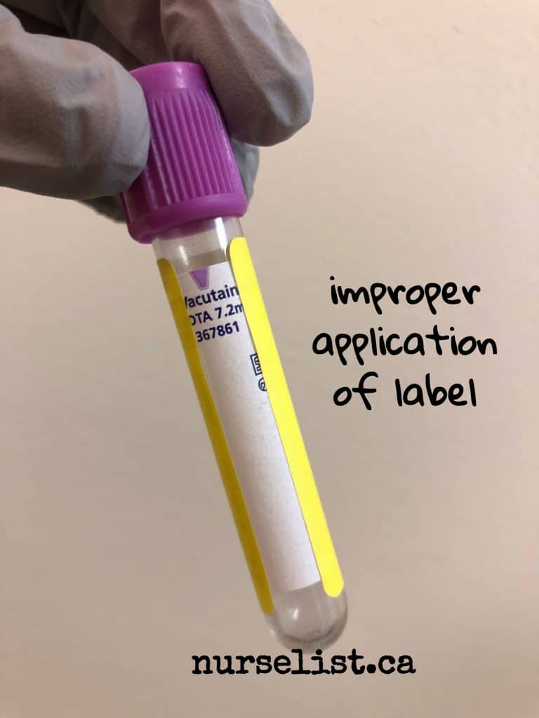 improper labeling of blood sample