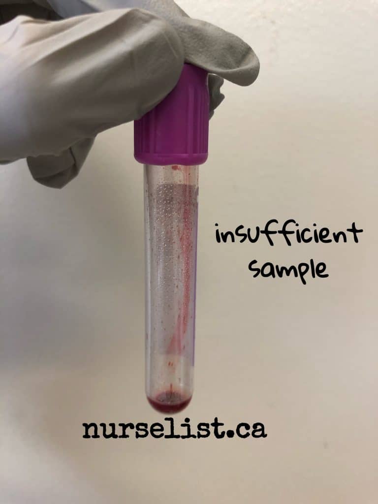 insufficient blood sample