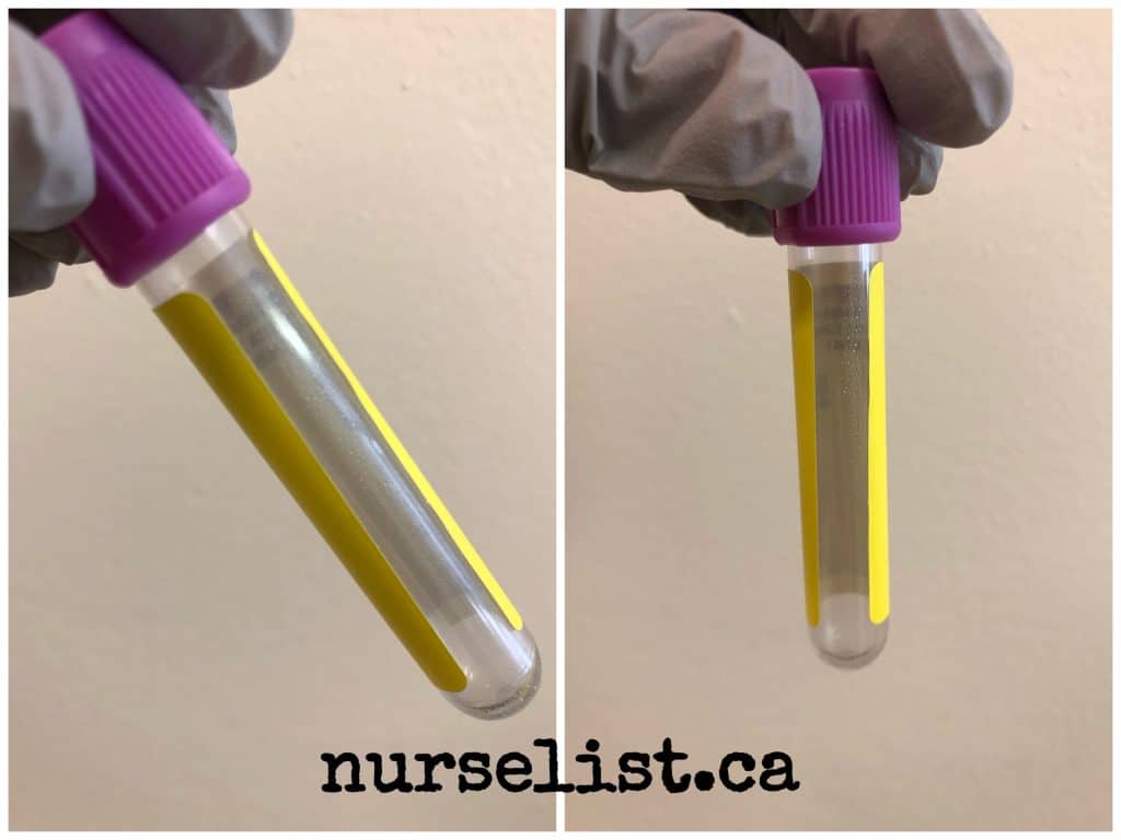 proper application of label in blood tubes